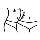 a1